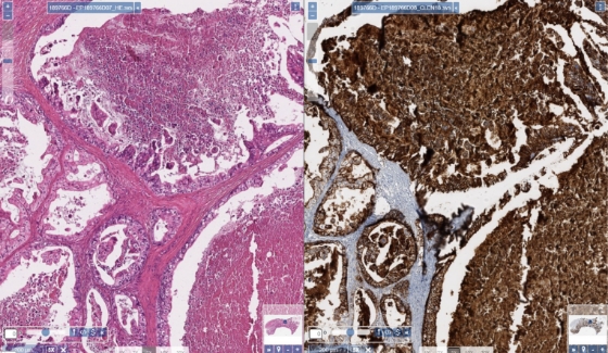 stain-interpretation